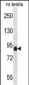 CCNT1 Antibody (Center)